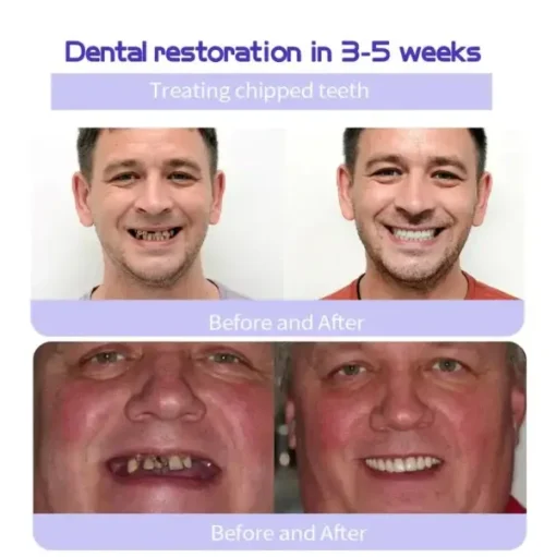 Cvreoz™ Teeth Restoration Mineral Powder - Image 4