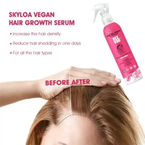 DeeVoo™ Luxe Bee venom Scalp Treatment HairGrᴏᴡth Hair Spray - Image 4