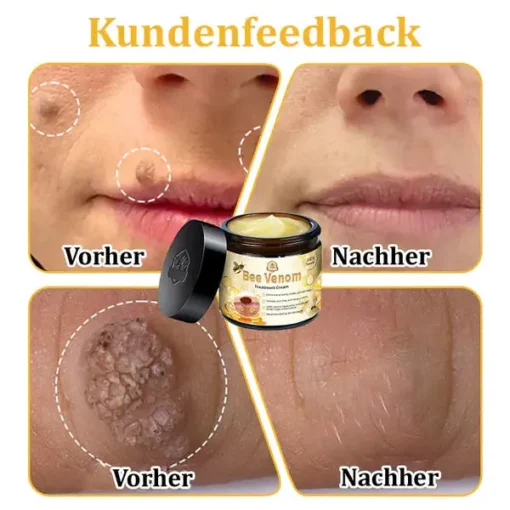 Dermatest-Zertifizierung | Turonu™ Bienengift-Hautcreme - Image 10