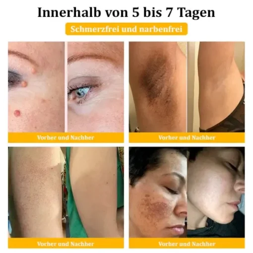 Dermatest-Zertifizierung | Turonu™ Bienengift-Hautcreme - Image 7