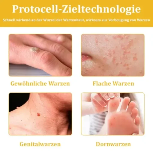 Dermatest-Zertifizierung | Turonu™ Bienengift-Hautcreme - Image 8