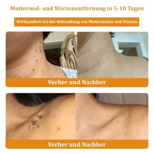 Dermatest-Zertifizierung | Turonu™ Bienengift-Hautcreme - Image 9