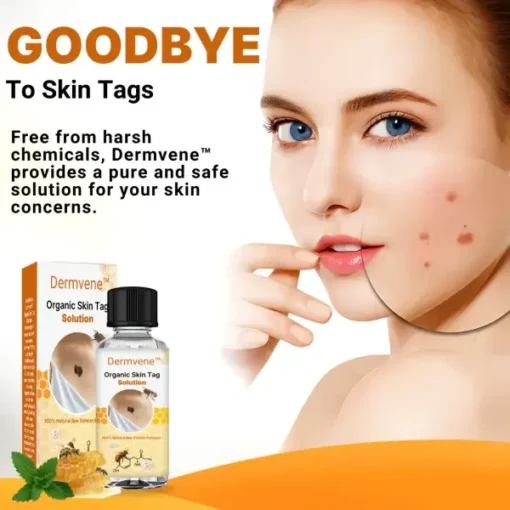 Dermvene™ Organic Skin Tag Solution - Image 3