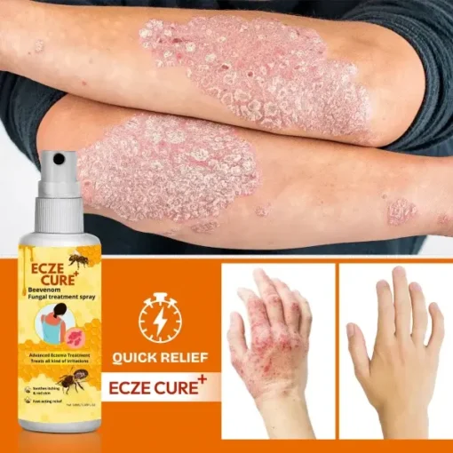 Eczecure+™ Bee Venom Fungal Treatment Spray - Image 2