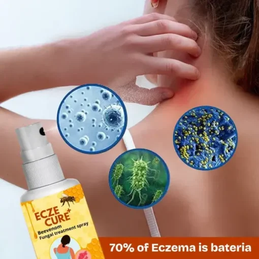 Eczecure+™ Bee Venom Fungal Treatment Spray - Image 3