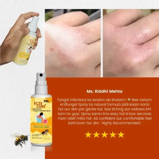 Eczecure+™ Bee Venom Fungal Treatment Spray - Image 8