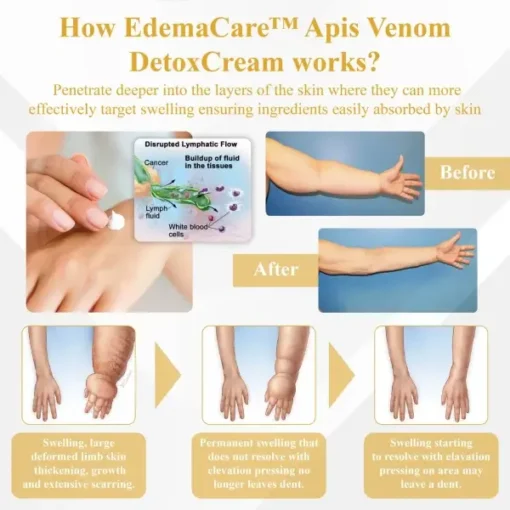 EdemaCare™ Apis Venom DetoxCream - Image 7