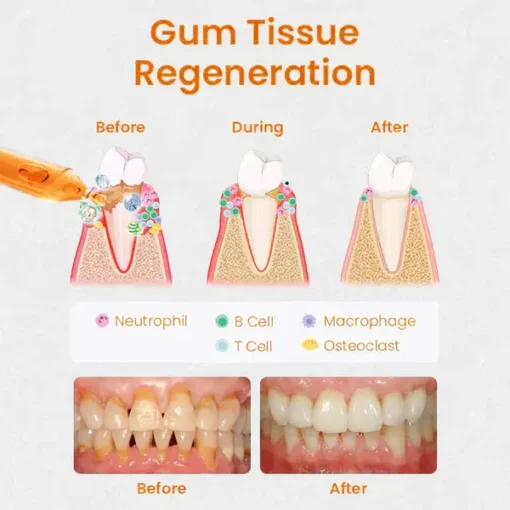 Fivfivgo™ Blister Gum Repair Ampoule - Image 5