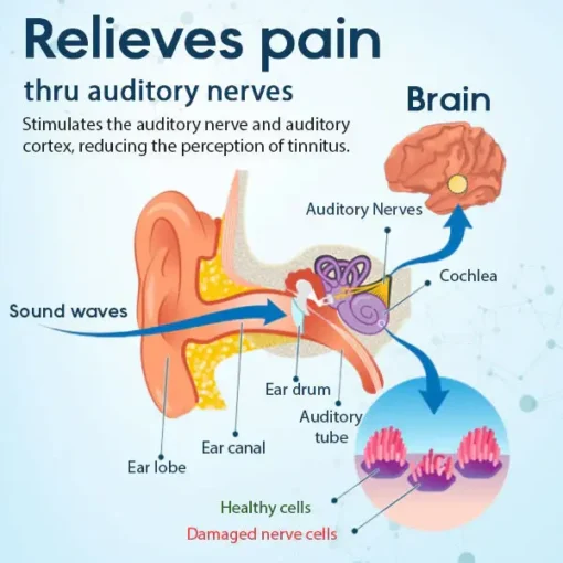 Fivfivgo™ Ohrpflaster zur Tinnitus-Behandlung - Image 4