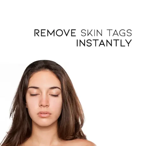 Fivfivgo™ WipeOff Tags & Mole Remover - Image 3