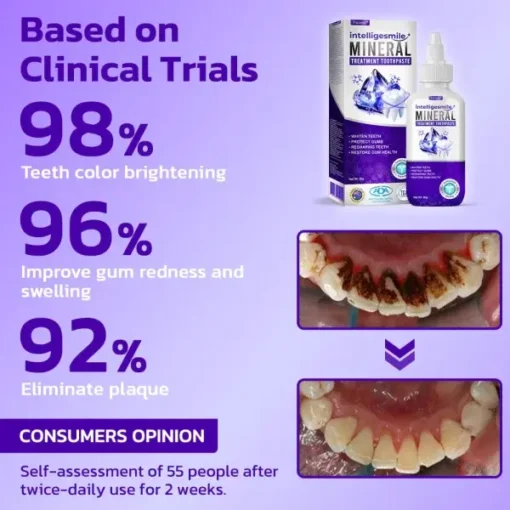 Furzero™ IntelligeSmile Mineral Treatment Toothpaste - Image 4