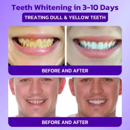 Furzero™ IntelligeSmile Mineral Treatment Toothpaste - Image 9