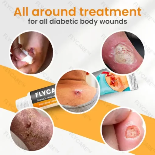 Holiday Sale FLYCARE™ Diabetic Wounds Treatment Cream - Image 4