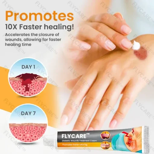 Holiday Sale FLYCARE™ Diabetic Wounds Treatment Cream - Image 6