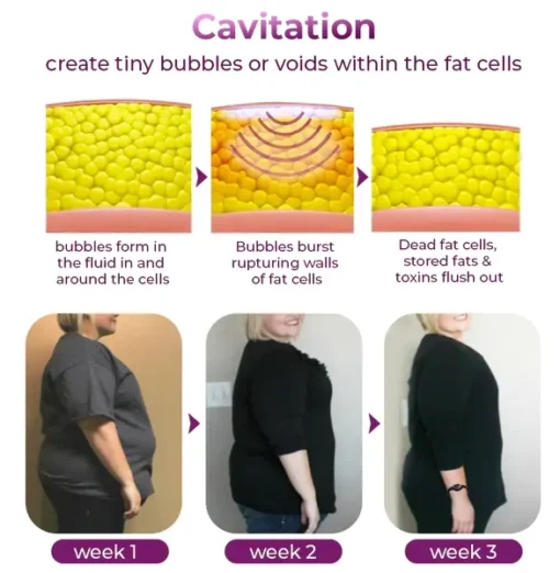 Holiday Sale SlimPulse™ Magnetic Fat Reduction and Detox Wristband - Image 7