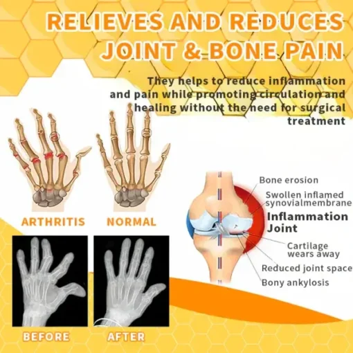 Holiday Sale TAILEDEN™ Bee Venom Joint Therapy Pain Relief Gel - Image 4