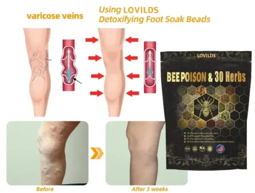 LOVILDS® Bee Poison & 30-Herb Detox Foot Soak Beads for Body Sculpting - Image 9