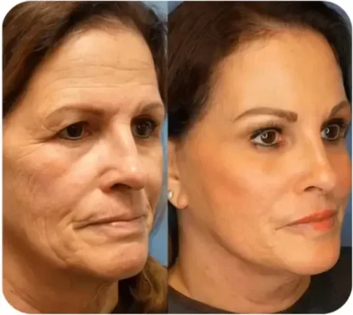 LOVILDS™ Instant face Tightener No-Filter Primer - Image 5