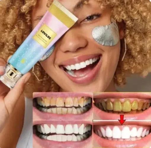 LOVILDS™ Niacinamide Whitening Toothpaste