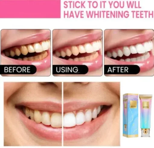 LOVILDS™ Niacinamide Whitening Toothpaste - Image 2