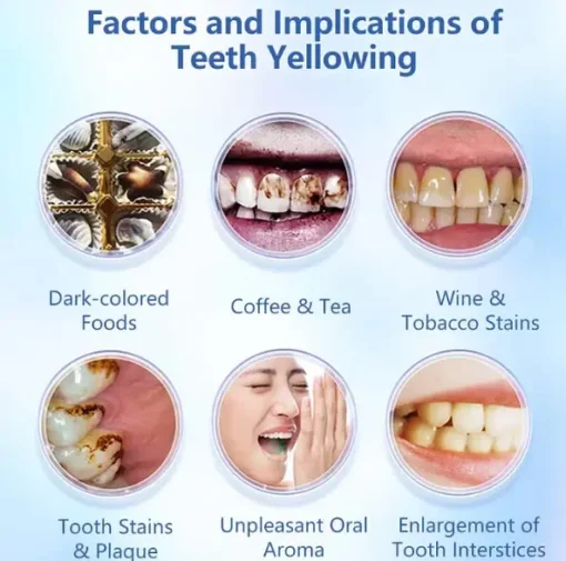 LOVILDS™ Niacinamide Whitening Toothpaste - Image 5