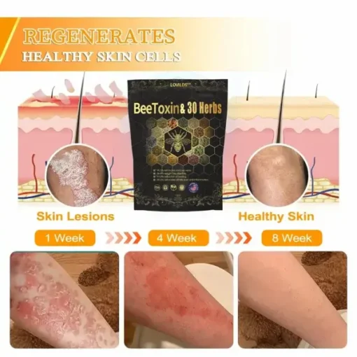 Lovilds™ Bee Toxin & 30-Herb Detox Foot Soak Beads for Body Sculpting - Image 12