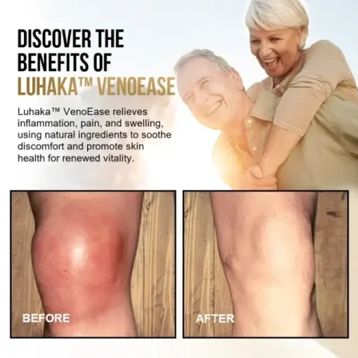 Luhaka™ VenoEase Swelling Reduction & Pain Relief Support - Image 4