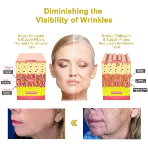 Luhaka™ Wrinkle Removel Cream - Image 9