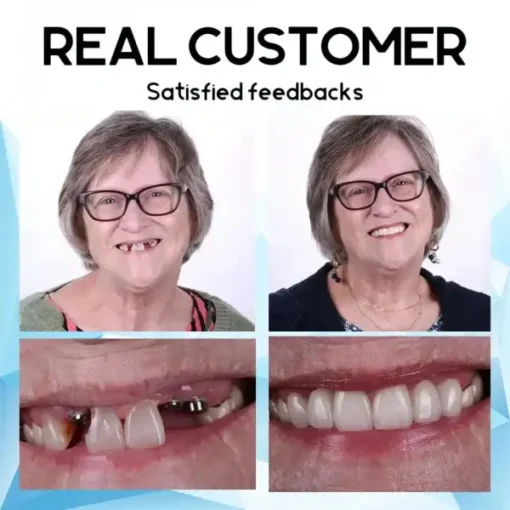 QIAWI – Holiday Smile Upgrade: The Best Dentures for Christmas & New Year! - Image 11