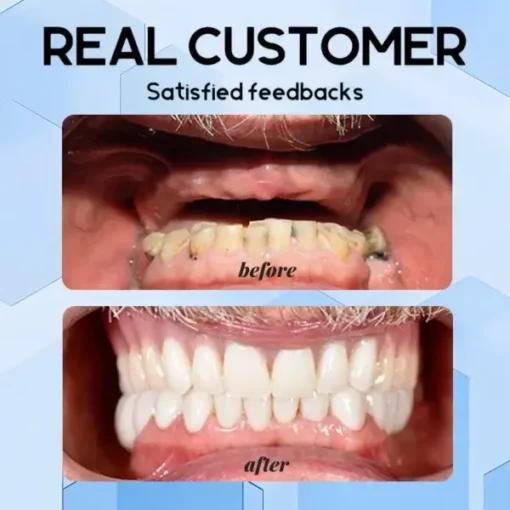 QIAWI – Holiday Smile Upgrade: The Best Dentures for Christmas & New Year! - Image 15