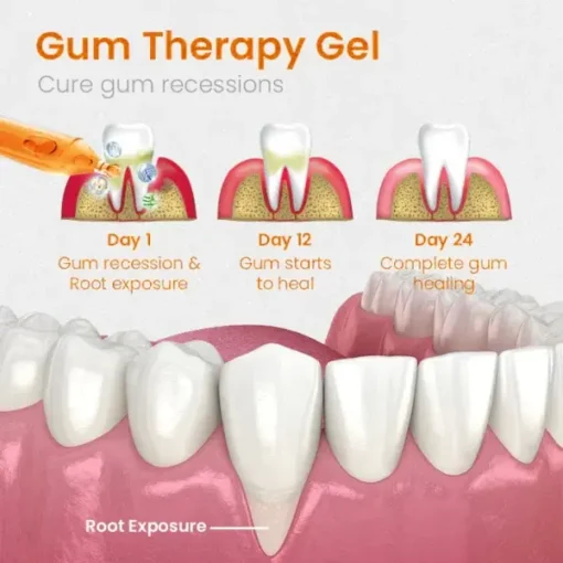 Ring in the New Year with a Smile: QIAWI™ Gum Repair - Image 2