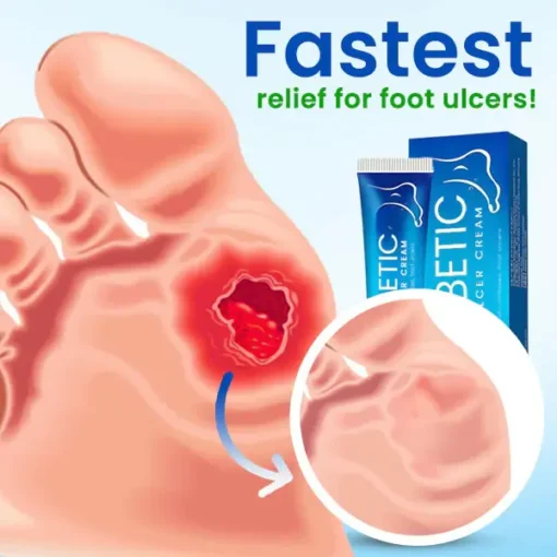 SootheStep™ Diabetic Foot Ulcer Cream - Image 3