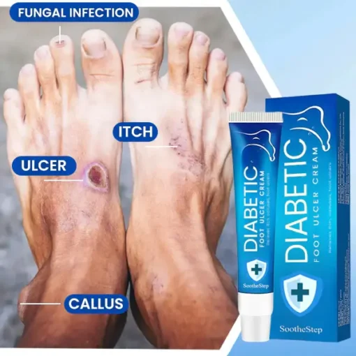 SootheStep™ Diabetic Foot Ulcer Cream - Image 5