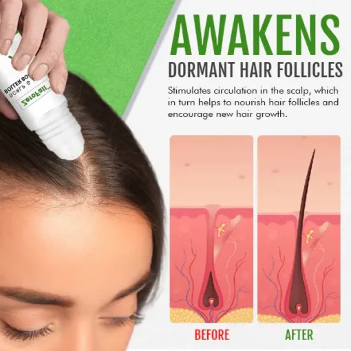 ZeroFall™ Scalp & Hair Roller Booster – Proven and Tested by Dermatologist - Image 3