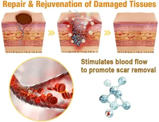 flysmus™ Lidocaine Scar-Free Pain Relief Healing Liquid - Image 6